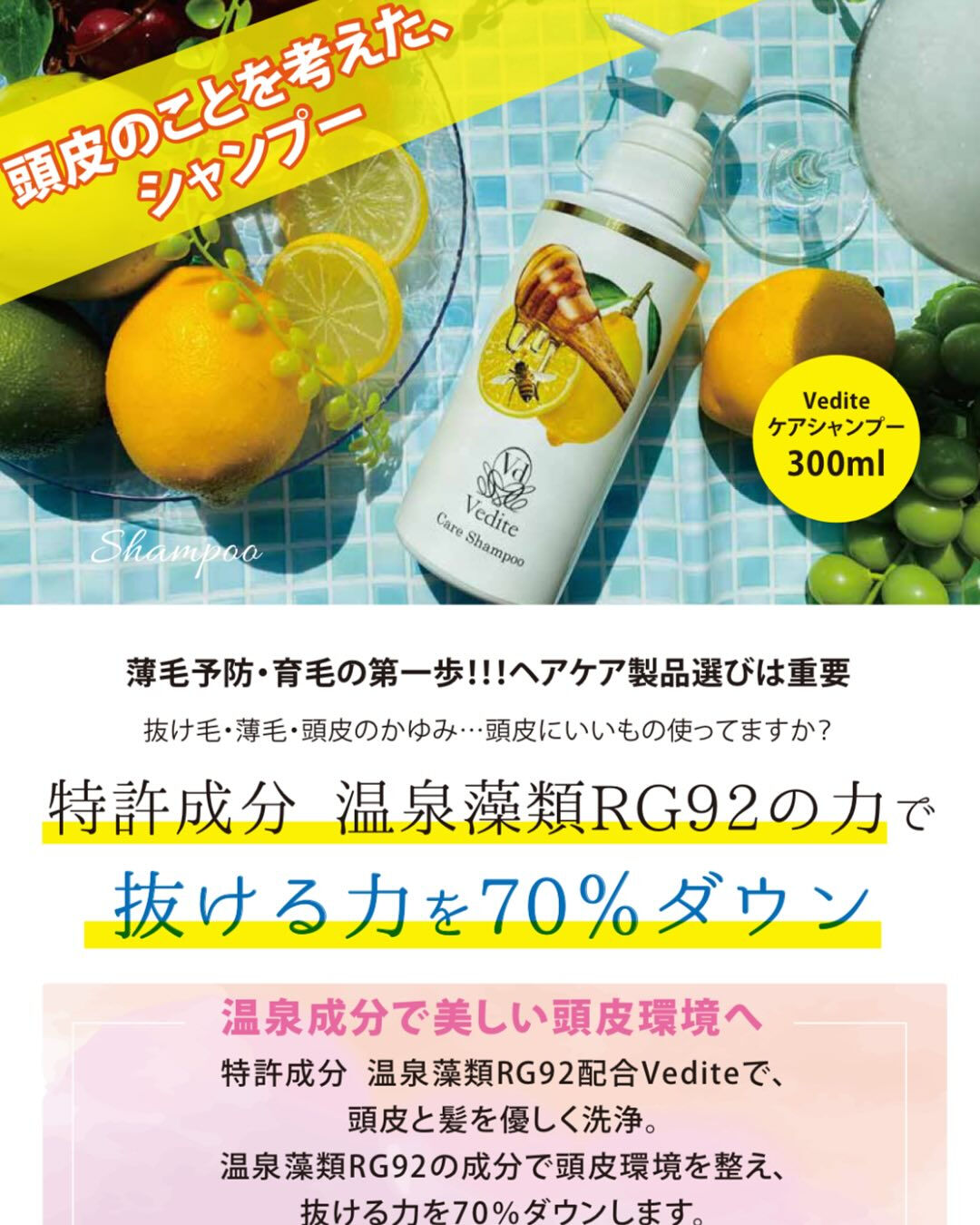 最近、分け目が広がったり、頭頂部のボリュームが減ったと感じま